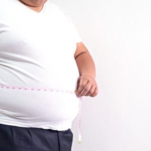 otyły mężczyzna przed liposukcją